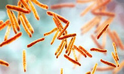 Mycobacterium tuberculosis